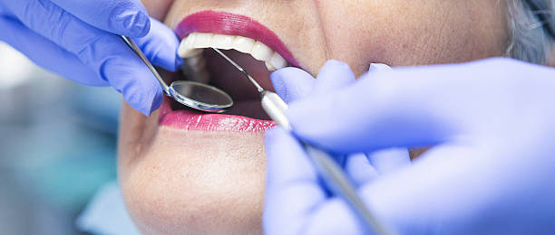 Best Emergency Tooth Extraction in Kentwood, MI